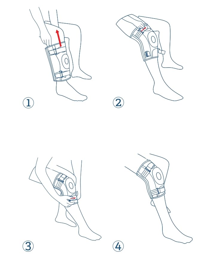 NEENCA Professional Knee Brace for Knee Pain, Hinged Knee Support with Removable Dual Side Stabilizers, Strong Stability for Joint Pain Relief, Arthritis, Meniscus Tear, ACL, PCL, MCL, Runner, Workout